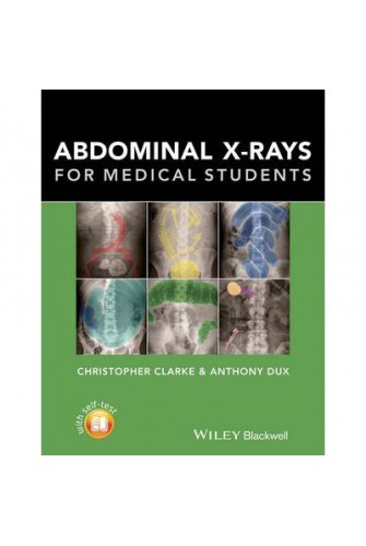 Abdominal X-rays for Medical Students 1st Edition