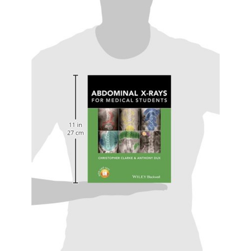 Abdominal X-rays for Medical Students 1st Edition